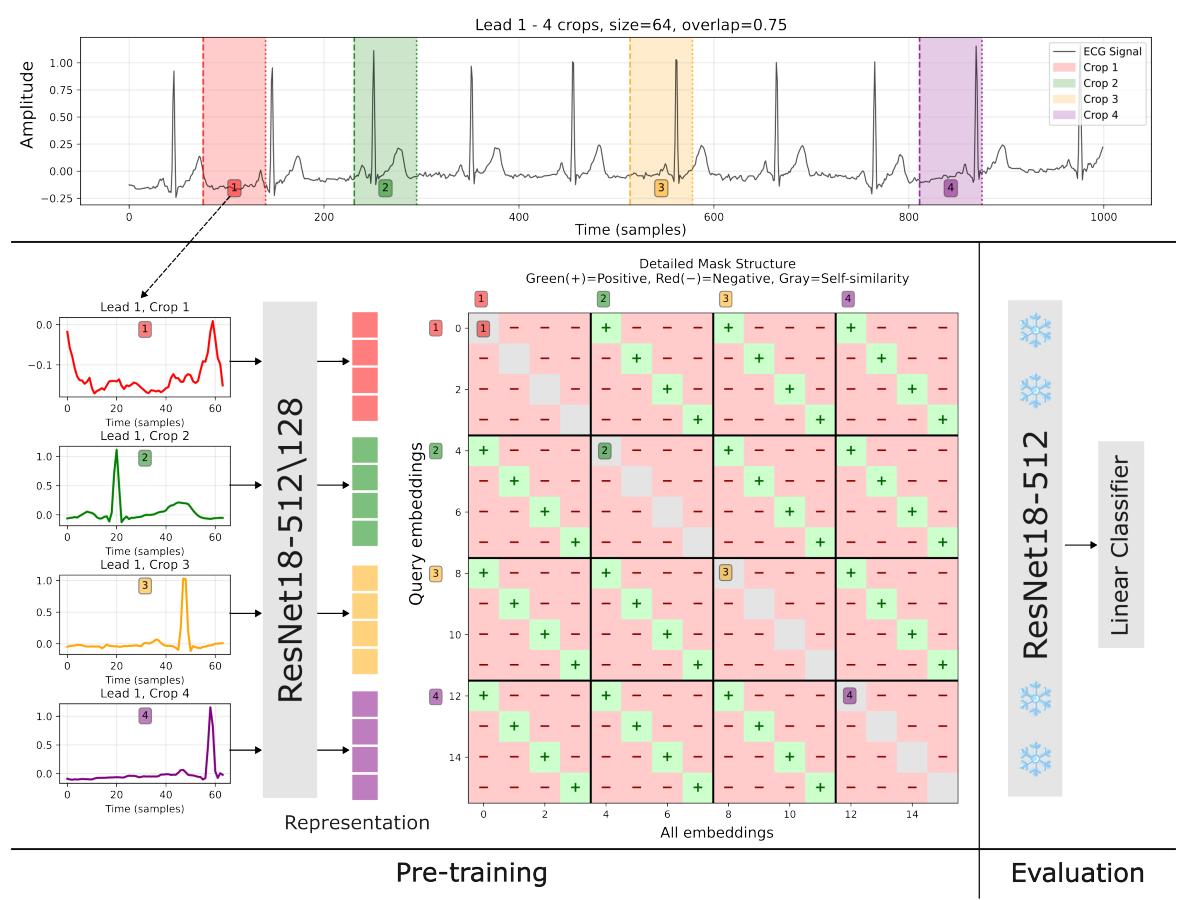 Learning ECG Representations paper figure